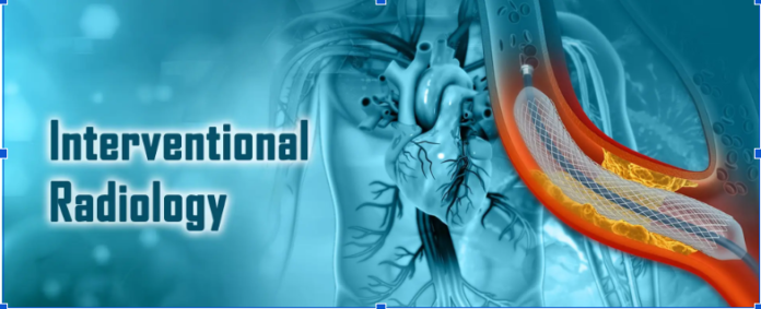 Prostate Artery Embolization Treatment in Ahmedabad